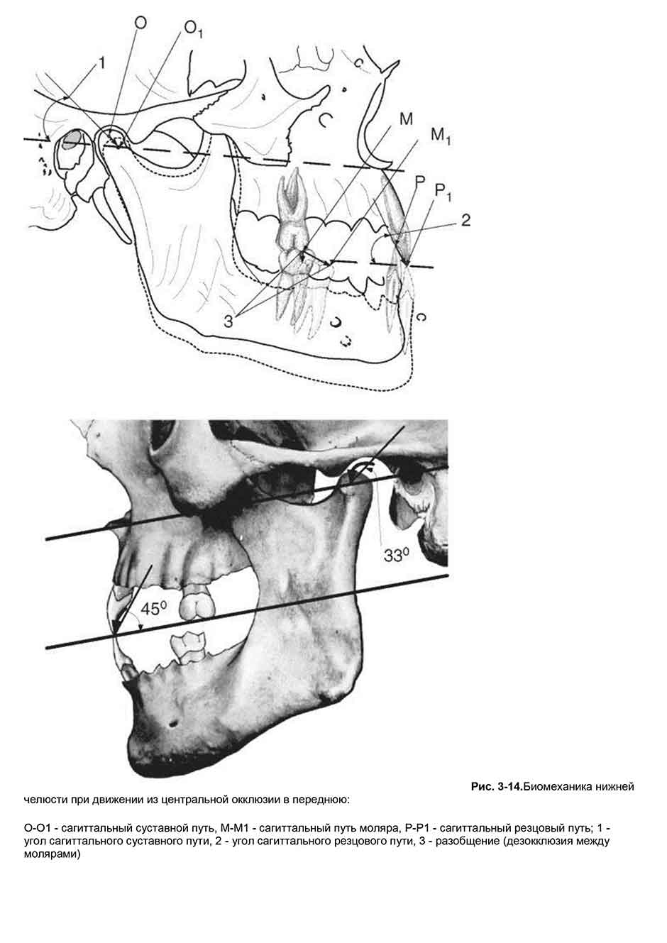 Рис. 3-14.Биомеханика нижней челюсти при движении из центральной окклюзии в переднюю