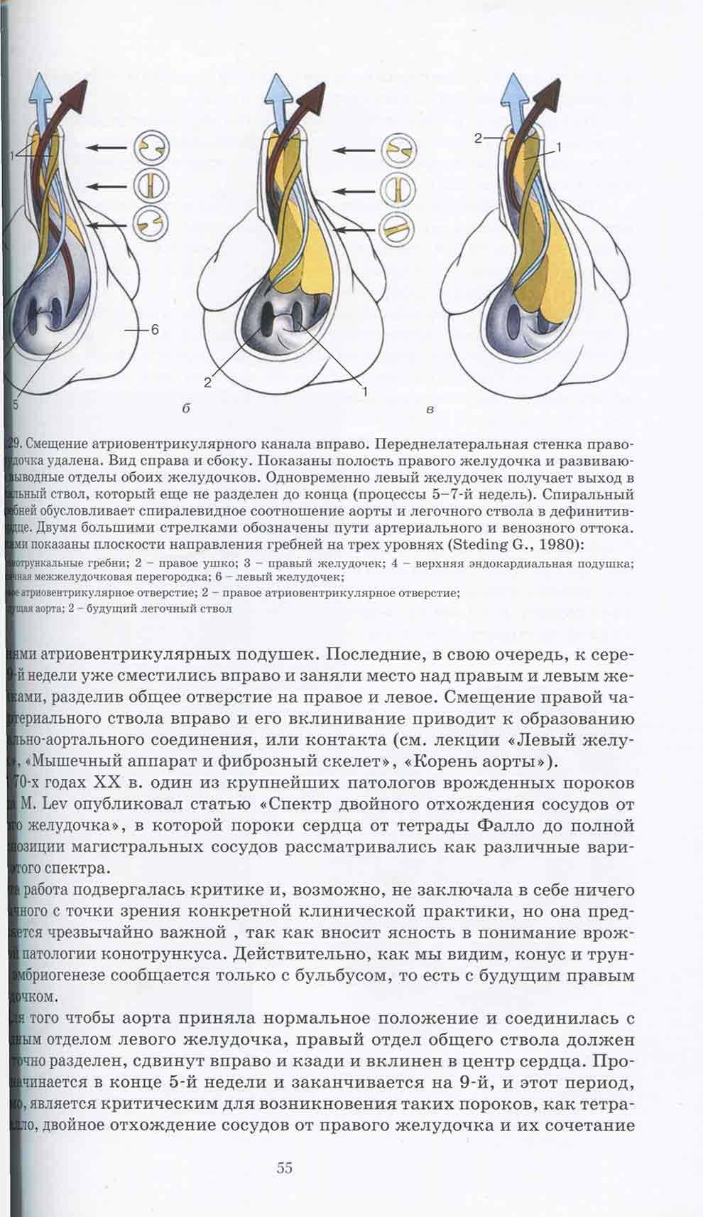 Смещение атриовентрикулярного канала вправо