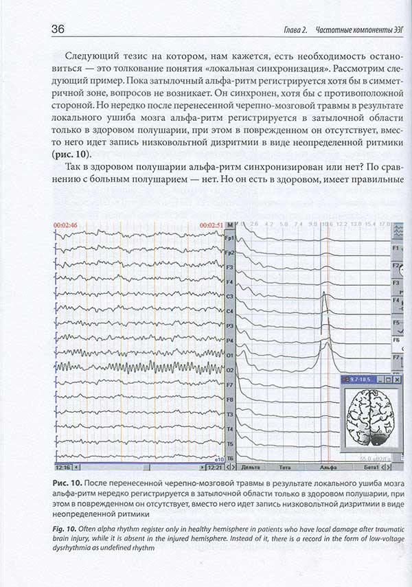 Примеры станиц из книги "Неэпилептическая электроэнцефалография"