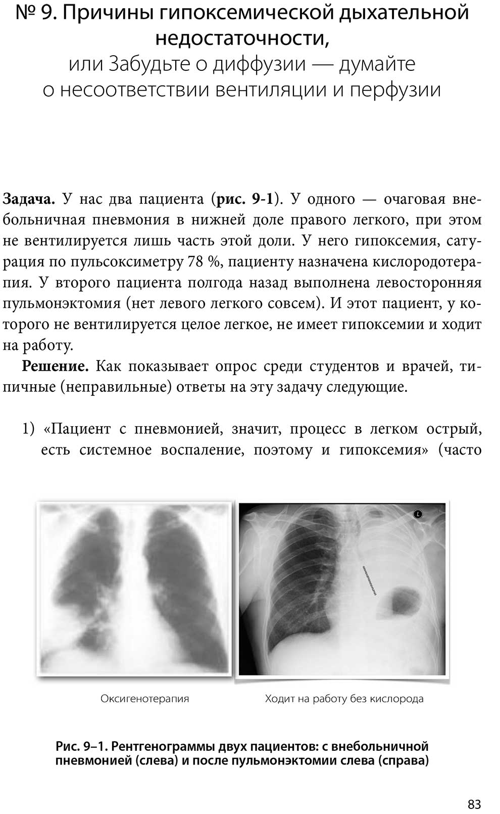 Рентгенограммы двух пациентов