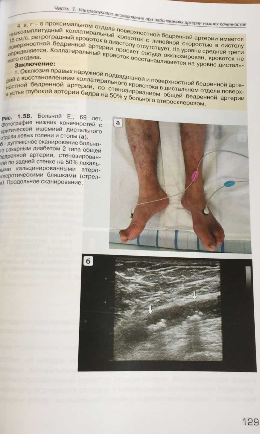 Пример страницы из книги "Ультразвуковое исследование при заболеваниях артерий и вен нижних конечностей"