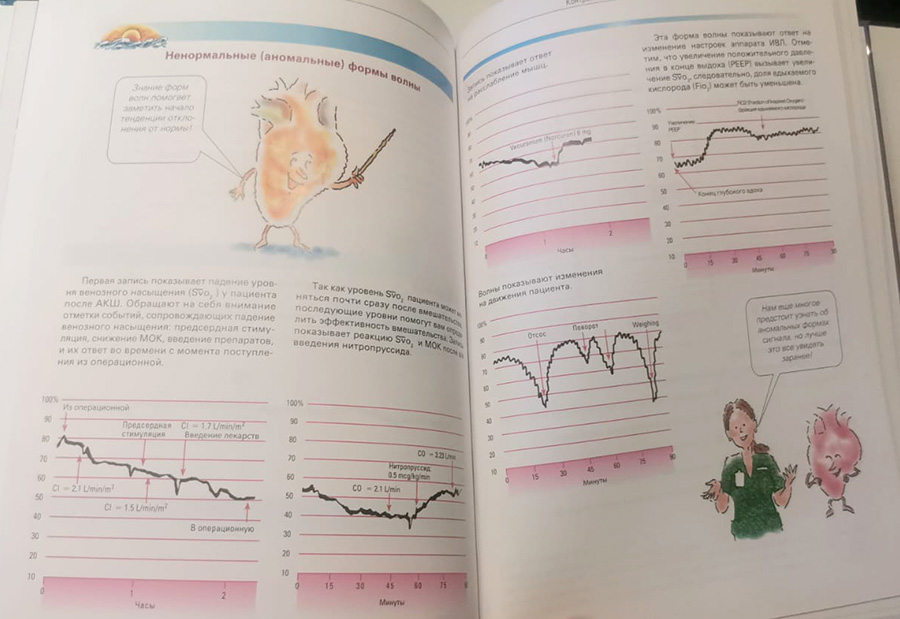 Пример страницы из книги "Гемодинамический мониторинг. Делай неожиданное видимым!" - Роуз Кнапп