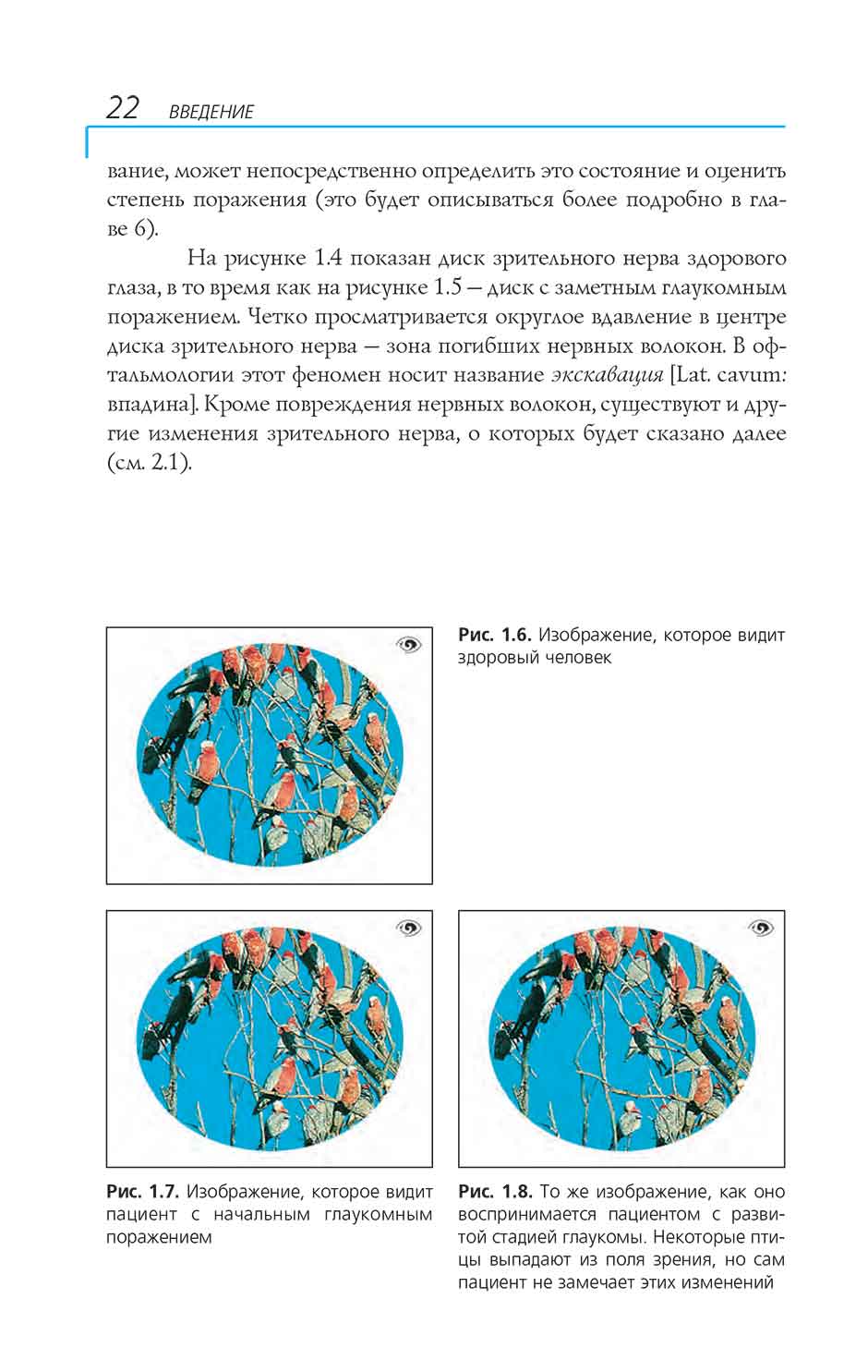 Рис. 1.7. Изображение, которое видит пациент с начальным глаукомным поражением