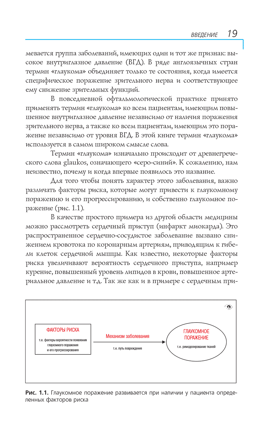 Рис. 1.1. Глаукомное поражение развивается при наличии у пациента определенных факторов риска