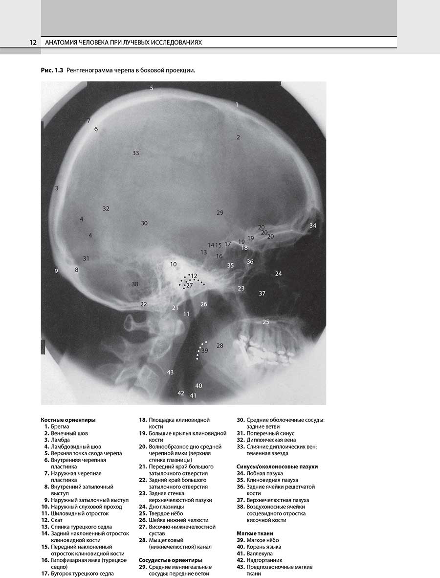 Рис. 1.3 Рентгенограмма черепа в боковой проекции.