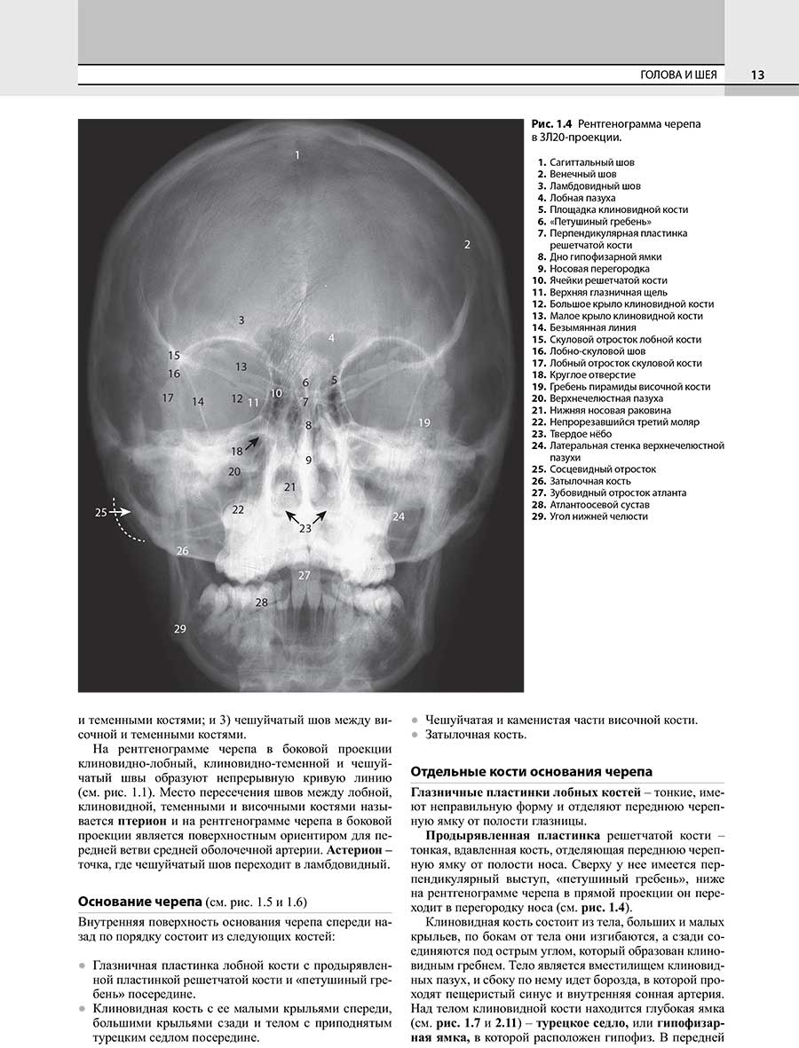 Рис. 1.4 Рентгенограмма черепа в ЗЛ20-проекции.