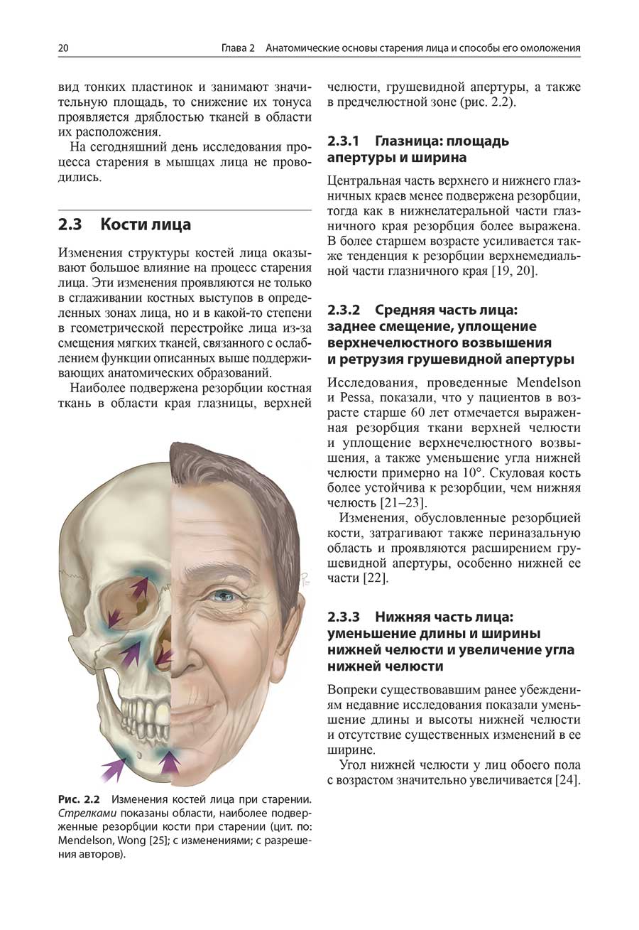 Рис. 2.2 Изменения костей лица при старении.