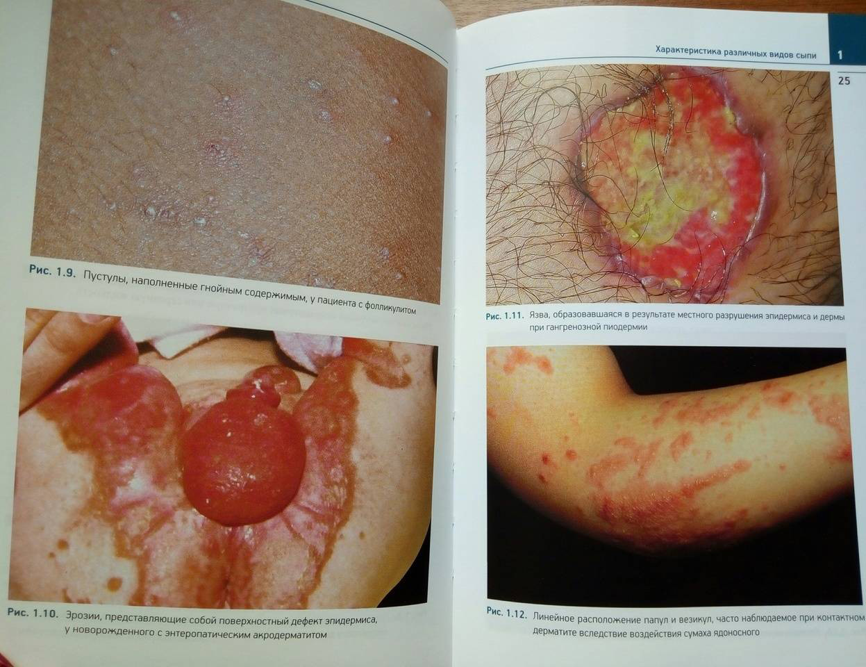 Пример страницы из книги "Детская дерматология. Справочник" - Манчини А. Дж.