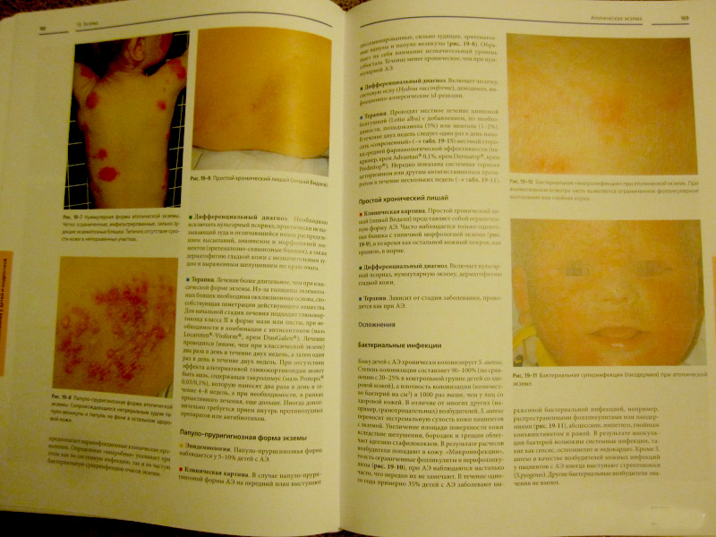 Пример страницы из книги "Детская дерматология" - Хёгер Петер Г.
