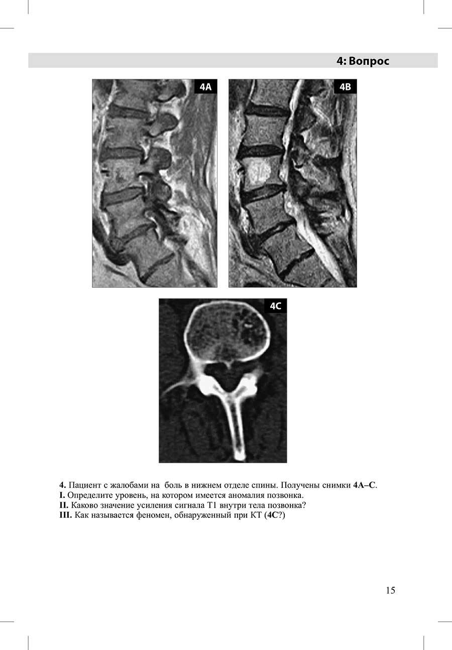 4. Пациент с жалобами на боль в нижнем отделе спины.