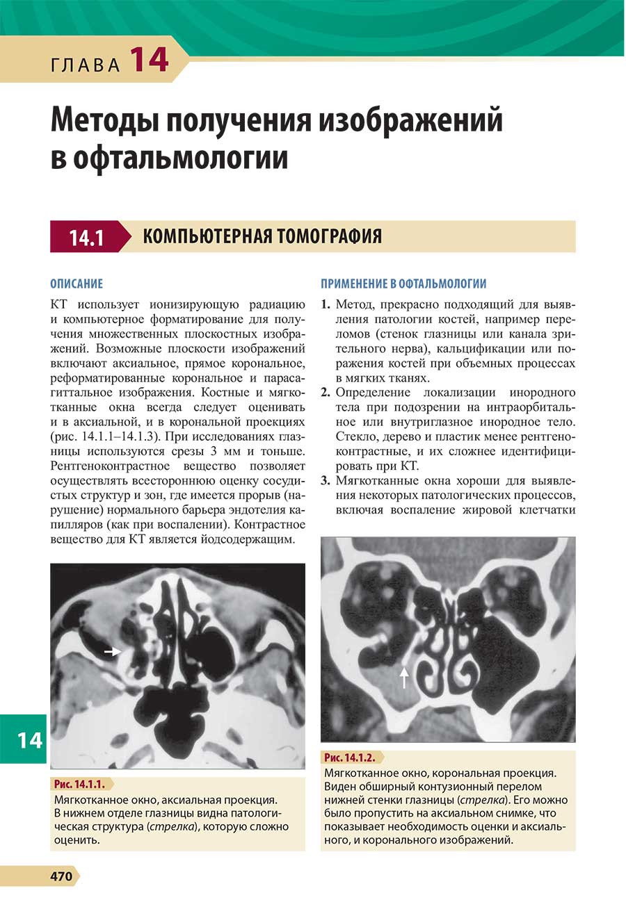 Мягкотканное окно, аксиальная проекция.