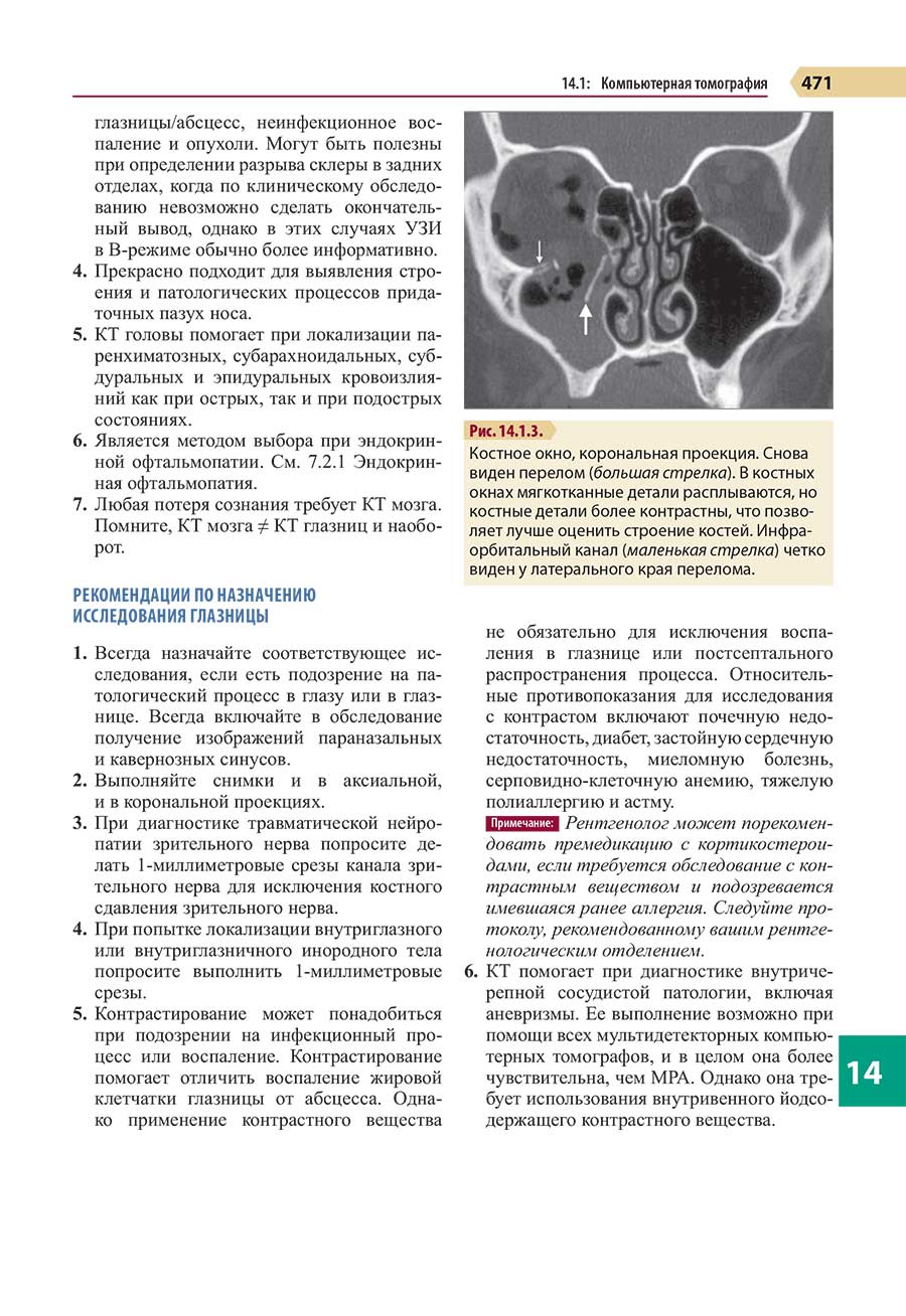 Костное окно, корональная проекция.