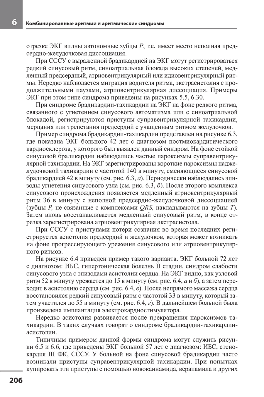 Пример страницы из книги "Руководство по практической электрокардиографии" - Дощицин В. Л.