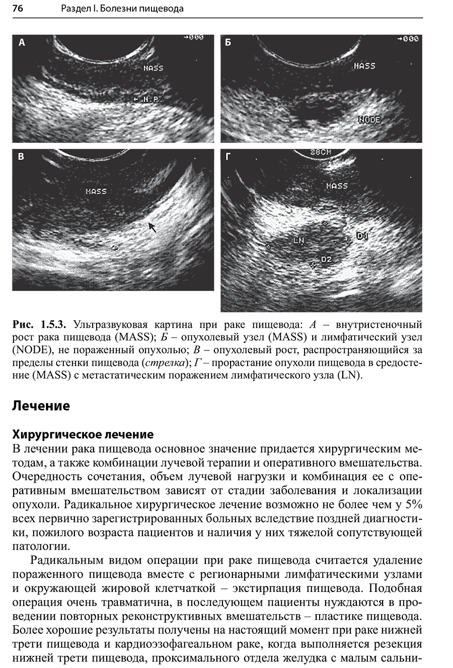 Пример страницы из книги "Гастроэнтерология и гепатология: диагностика и лечение"