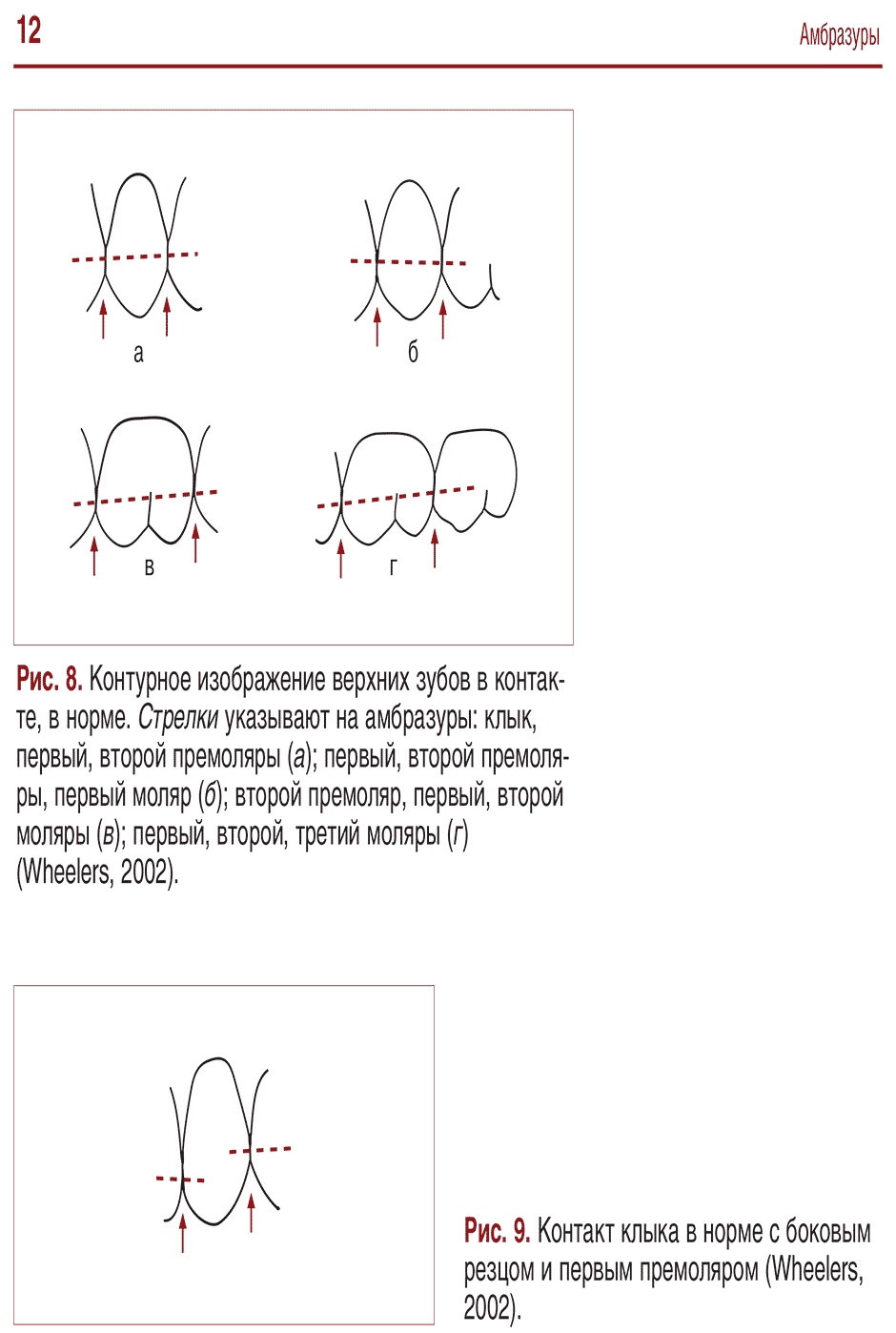 Рис. 9. Контакт клыка в норме с боковым резцом и первым премоляром (Wheelers, 2002).