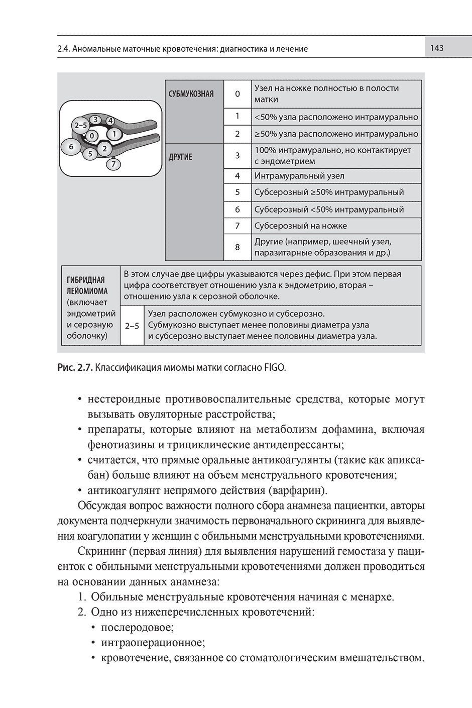 Рис. 2.7. Классификация миомы матки согласно FIGO.