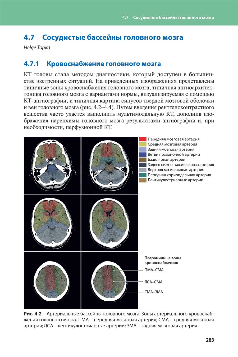 Рис. 4.2 Артериальные бассейны головного мозга.