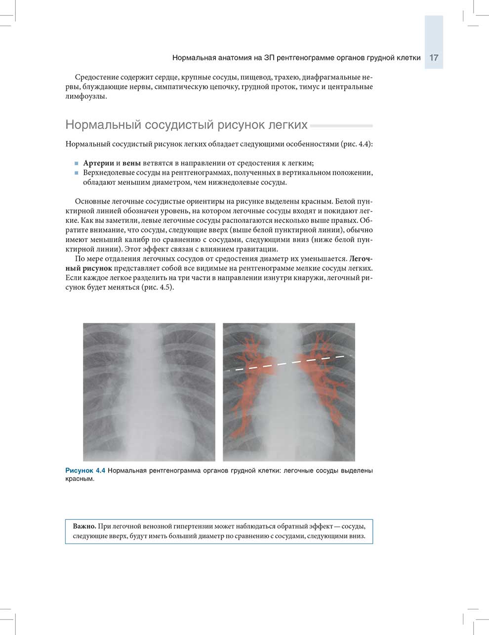 Рисунок 4.4 Нормальная рентгенограмма органов грудной клетки: легочные сосуды выделены красным