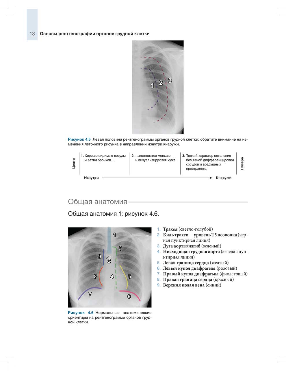 Рисунок 4.6 Нормальные анатомические ориентиры на рентгенограмме органов грудной клетки