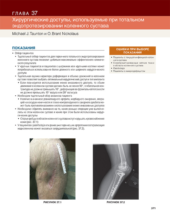 Хирургические доступы, используемые при тотальном эндопротезировании коленного сустава