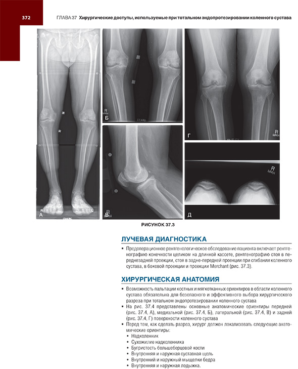 Хирургические доступы используемые при тотальном эндопротезировании коленного сустава