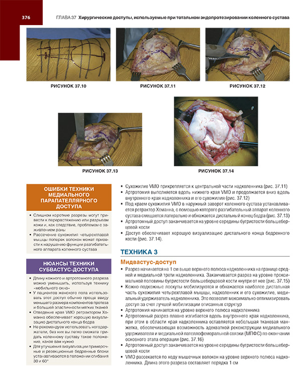 Хирургические доступы. Используемые при тотальном эндопротезировании коленного сустава