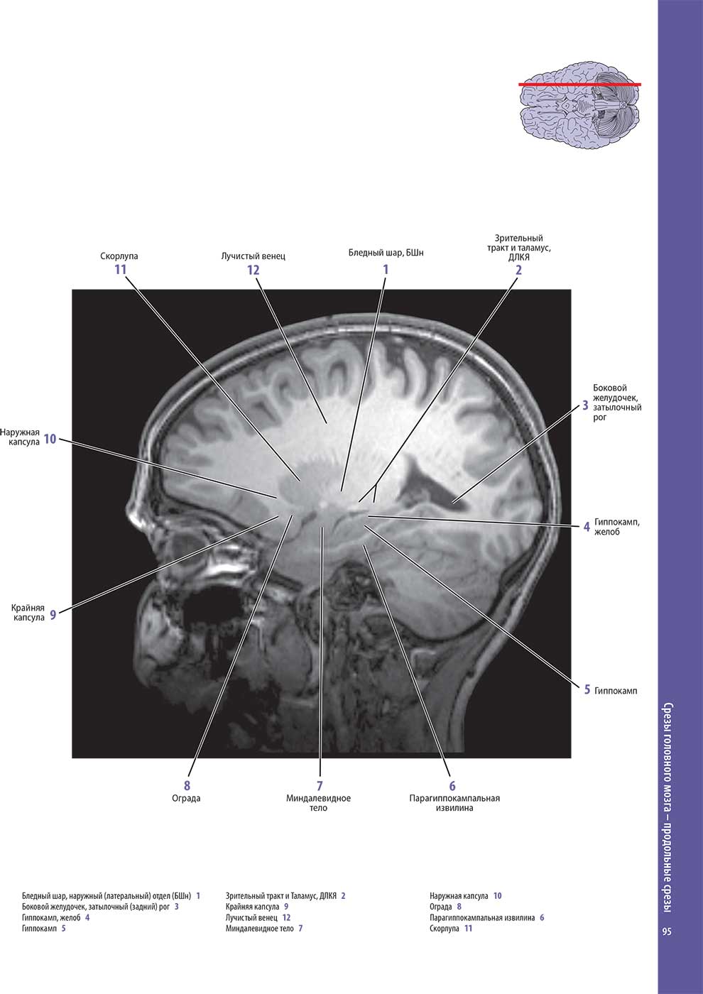 Пример страницы из книги "Атлас анатомии головного мозга" - Вулси Т. А. , Ханауэй Дж., Гадо М. Х.