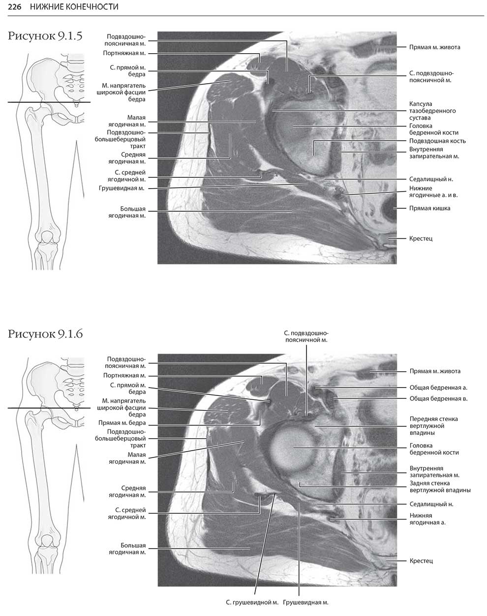 Пример страницы из книги "МРТ и КТ. Секционная анатомия" - Андерсон М. В., Фокс М. Дж.