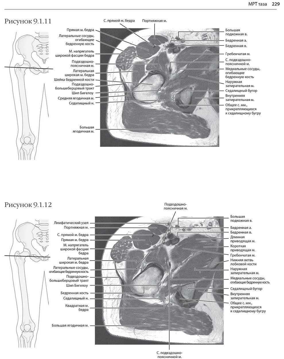 Пример страницы из книги "МРТ и КТ. Секционная анатомия" - Андерсон М. В., Фокс М. Дж.