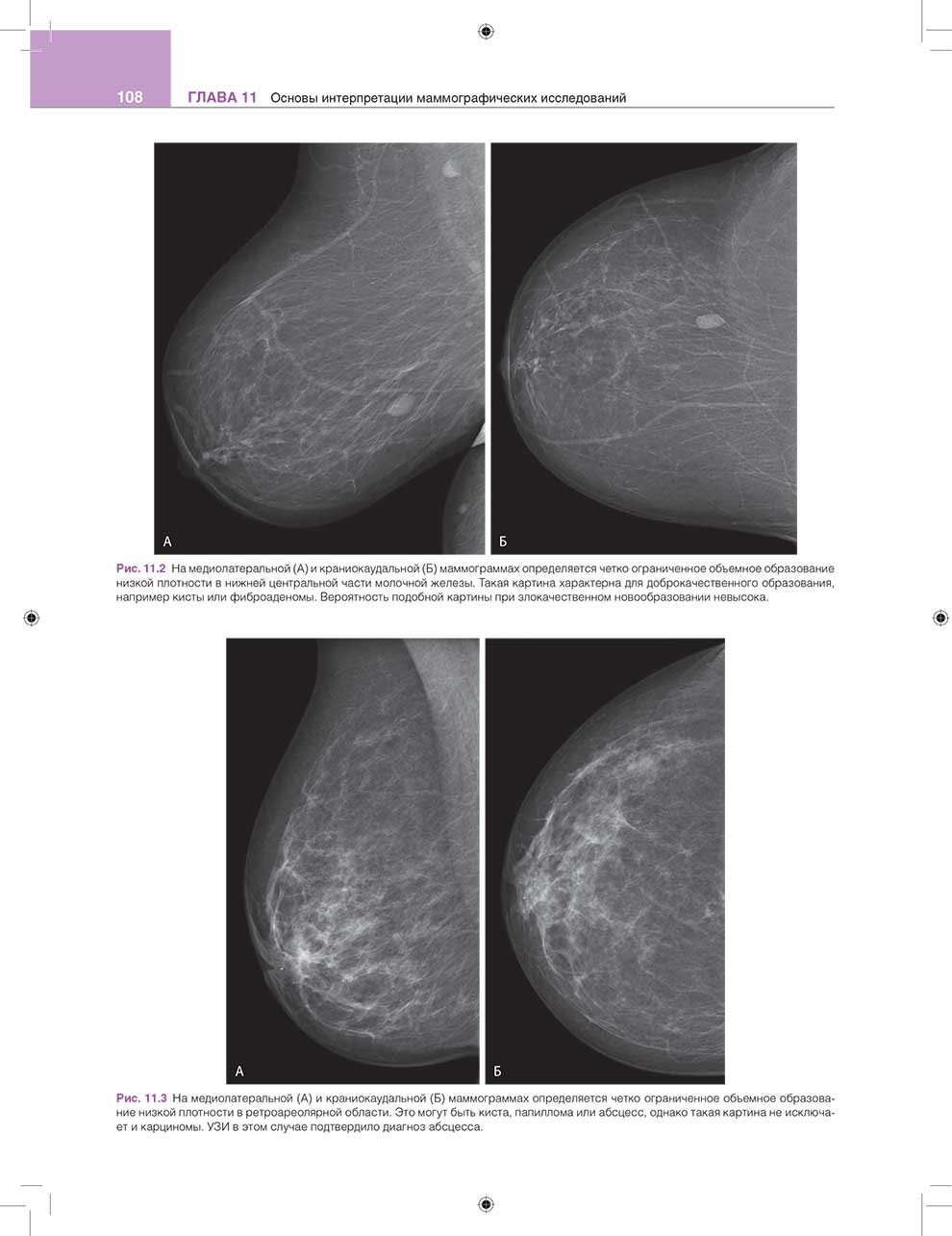 Основы интерпретации маммографических исследований