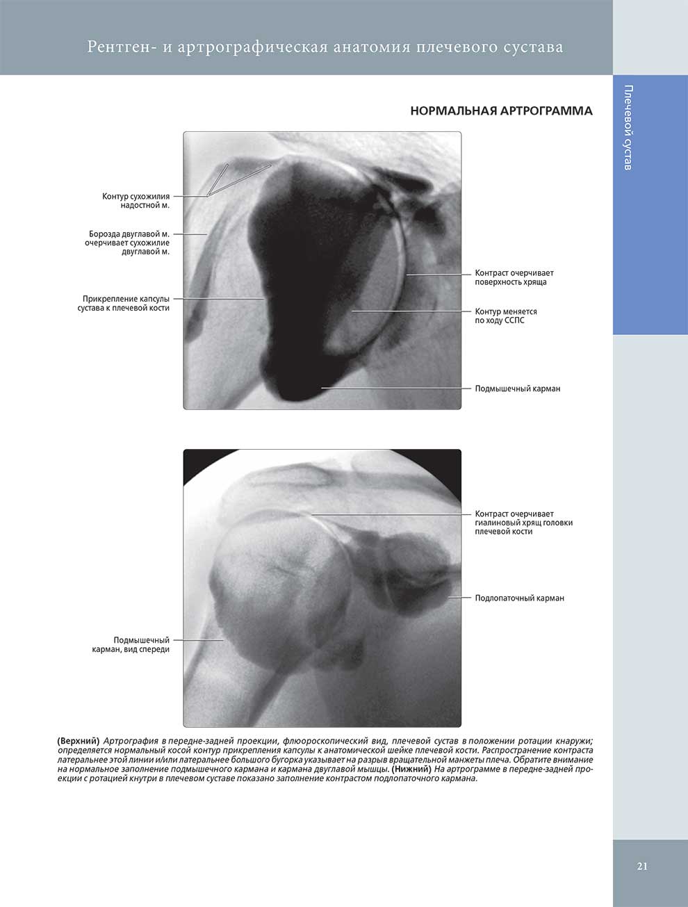 Рентген- и артрографическая анатомия плечевого сустава