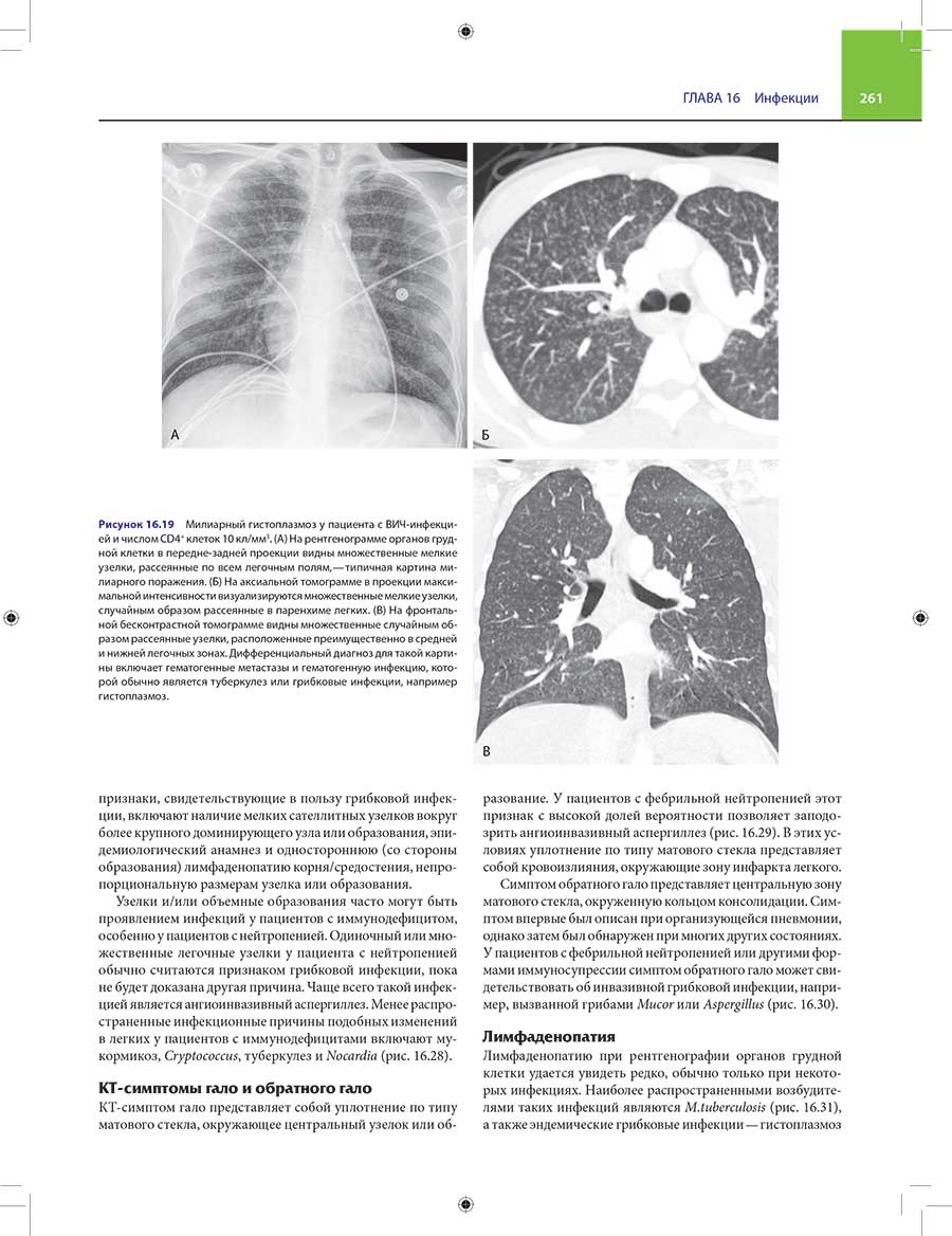 Пример страницы из книги "Лучевая диагностика заболеваний органов грудной клетки" - Субба Р. Дигумарти  