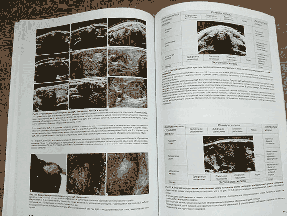 Пример страницы из книги "Ультразвуковая диагностика заболеваний щитовидной железы и эффективность ультразвукового скрининга в раннем выявлении рака и других заболеваний" - В. С. Паршин Пример страницы из книги "Ультразвуковая диагностика заболеваний щитовидной железы и эффективность ультразвукового скрининга в раннем выявлении рака и других заболеваний" - В. С. Паршин