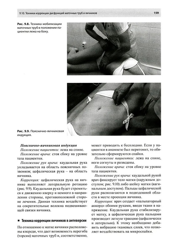 Пояснично-яичниковая индукция Пояснично-яичниковая индукция