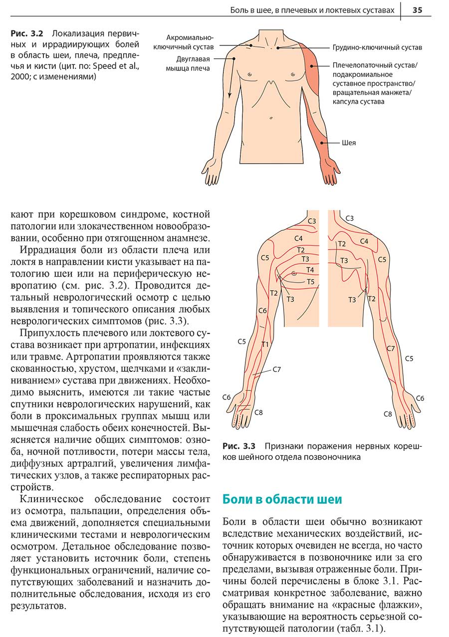 Рис. 3.3 Признаки поражения нервных корешков шейного отдела позвоночника