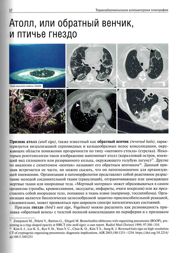 Признак атолл, также известный как обратный венчик । Признак атолл, также известный как обратный венчик ।