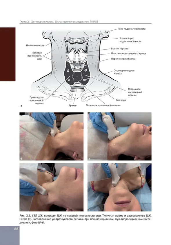 УЗИ щитовидной железы
