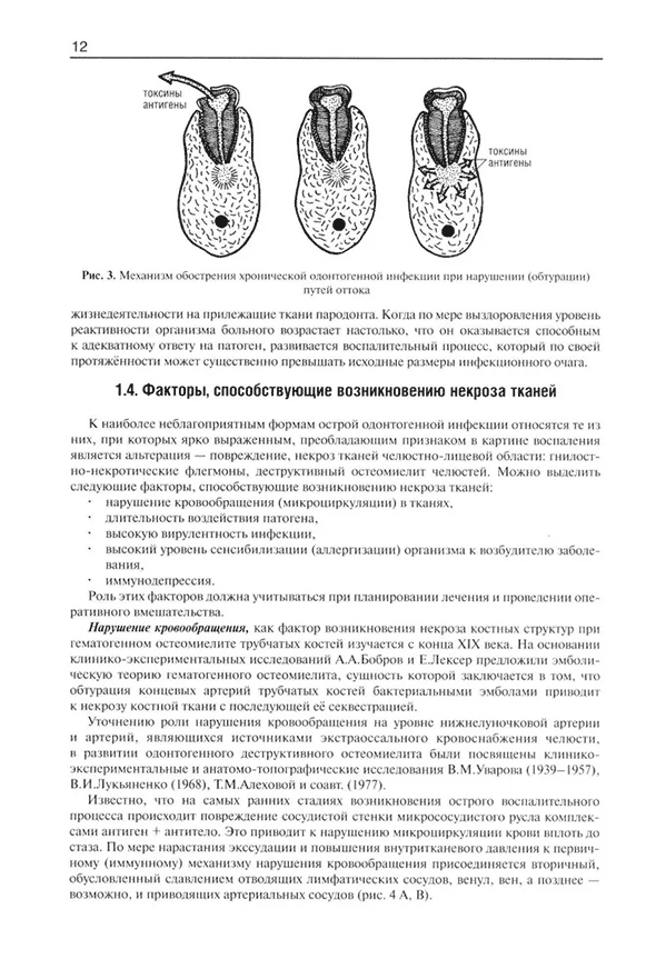 Механизм обострения хронических одонтогенных инфекций.