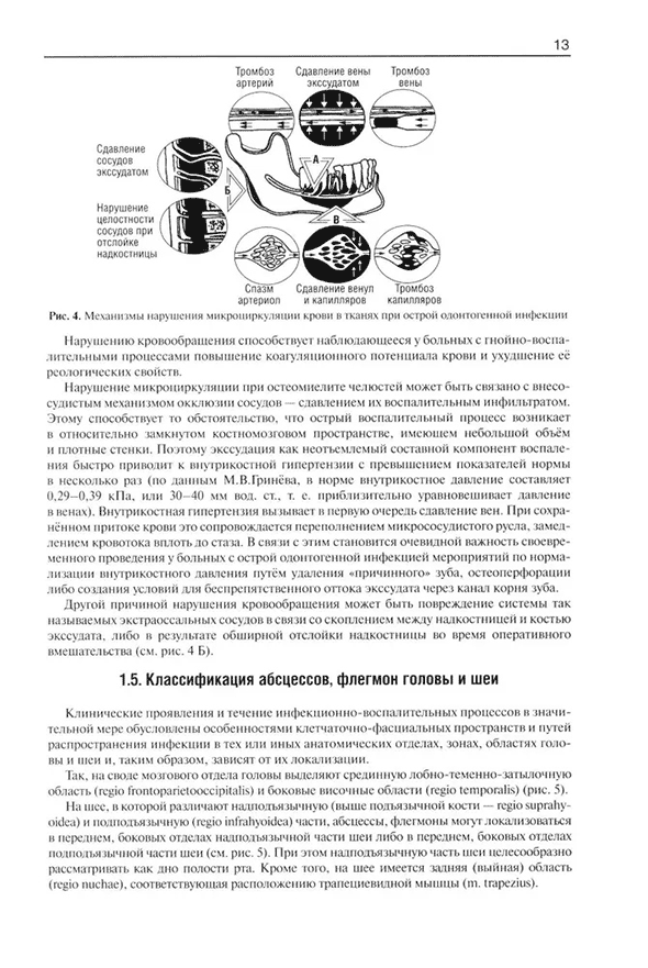 Механизм нарушения микроциркуляции крови