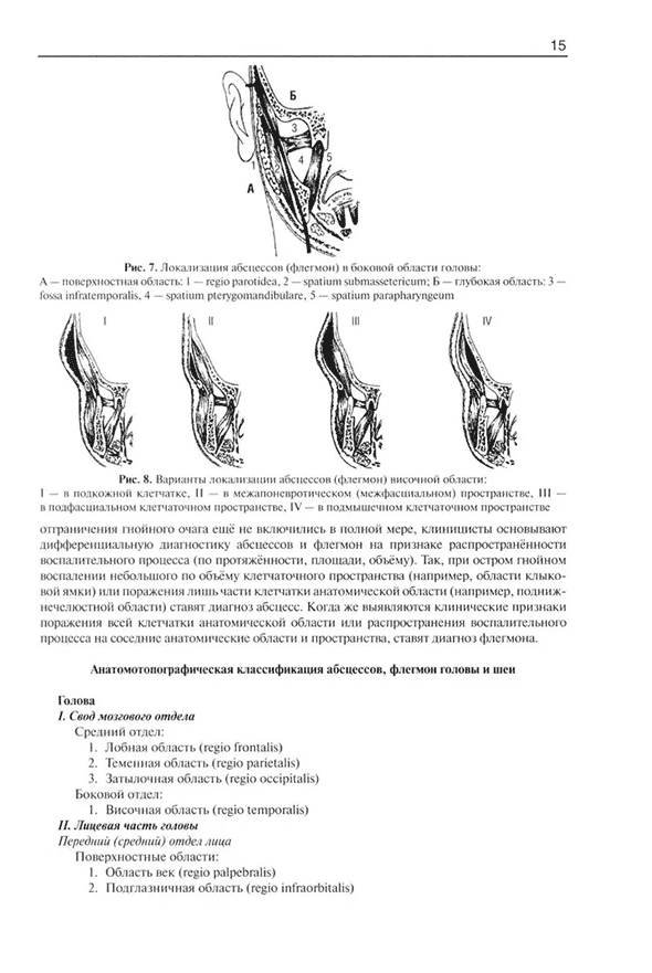 Варианты локализации абсцессов (флегмон) височной области