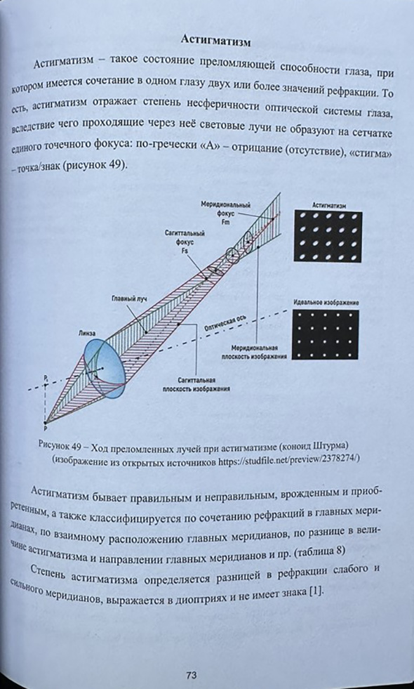 Астигматизм Астигматизм