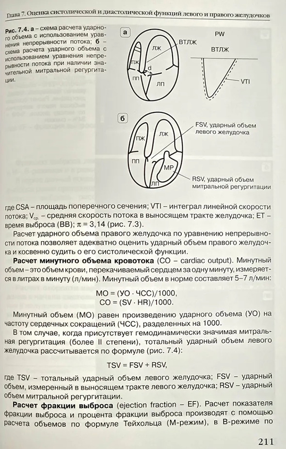 Оценка систолический и диастолической функции левого и правого желудочков