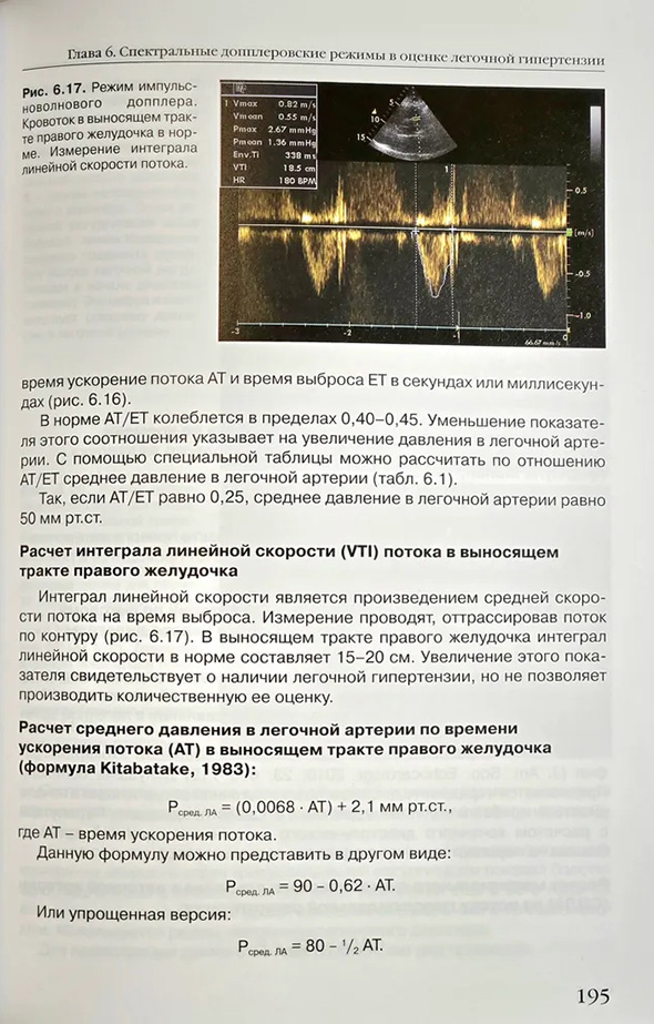 Режим импульсноволнового допплера