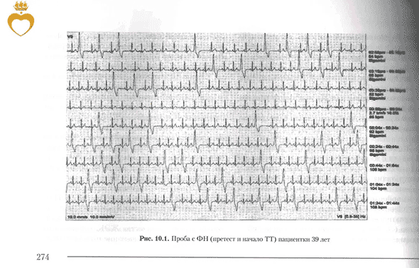 Пример страницы из книги  "Пробы с физической нагрузкой в аритмологии" - Трешкур Т. В.