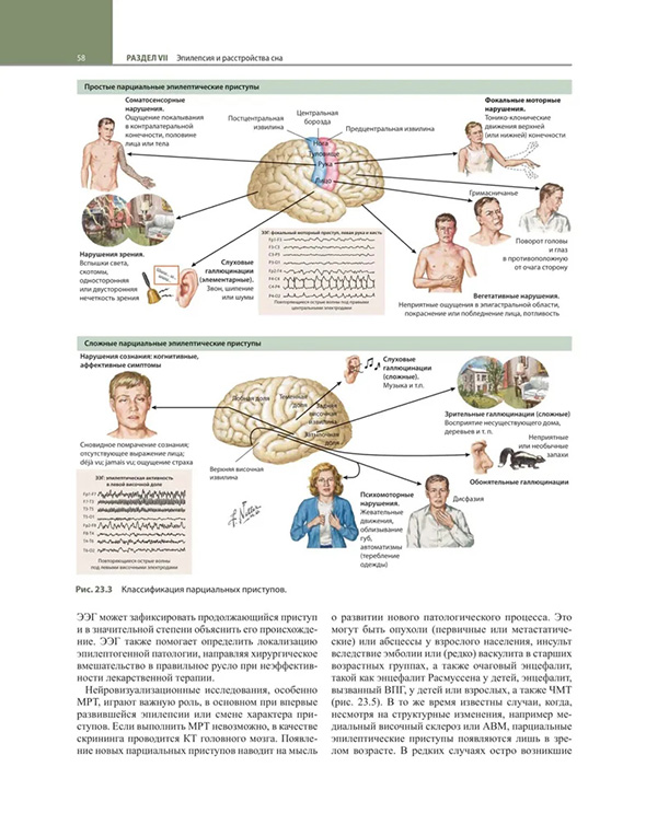 Пример страницы из книги "Неврология по Неттеру". Том 2 - Джаяшри Шринивасан, Клаудия ДЖ. Чавес, Брайан ДЖ. Скотт, Хуан Э. Смолл Пример страницы из книги "Неврология по Неттеру". Том 2 - Джаяшри Шринивасан, Клаудия ДЖ. Чавес, Брайан ДЖ. Скотт, Хуан Э. Смолл
