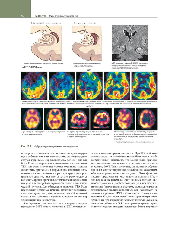 Пример страницы из книги "Неврология по Неттеру". Том 2 - Джаяшри Шринивасан, Клаудия ДЖ. Чавес, Брайан ДЖ. Скотт, Хуан Э. Смолл Пример страницы из книги "Неврология по Неттеру". Том 2 - Джаяшри Шринивасан, Клаудия ДЖ. Чавес, Брайан ДЖ. Скотт, Хуан Э. Смолл
