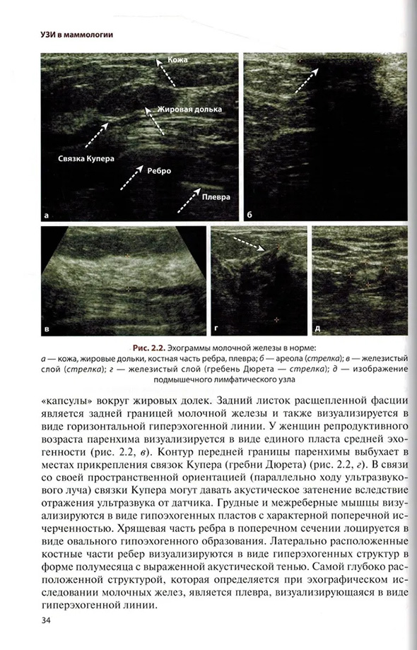 Эхограммы молочной железы в норме