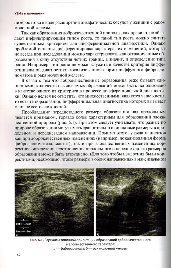 Варианты типичной ориентации образований доброкачественного и злокачественного характера