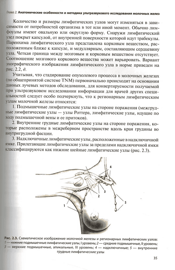 Схематическое изображение молочной железы и регионарных лимфатических узлов