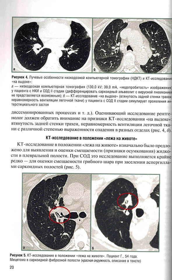 КТ-исследование в положении «лежа на животе